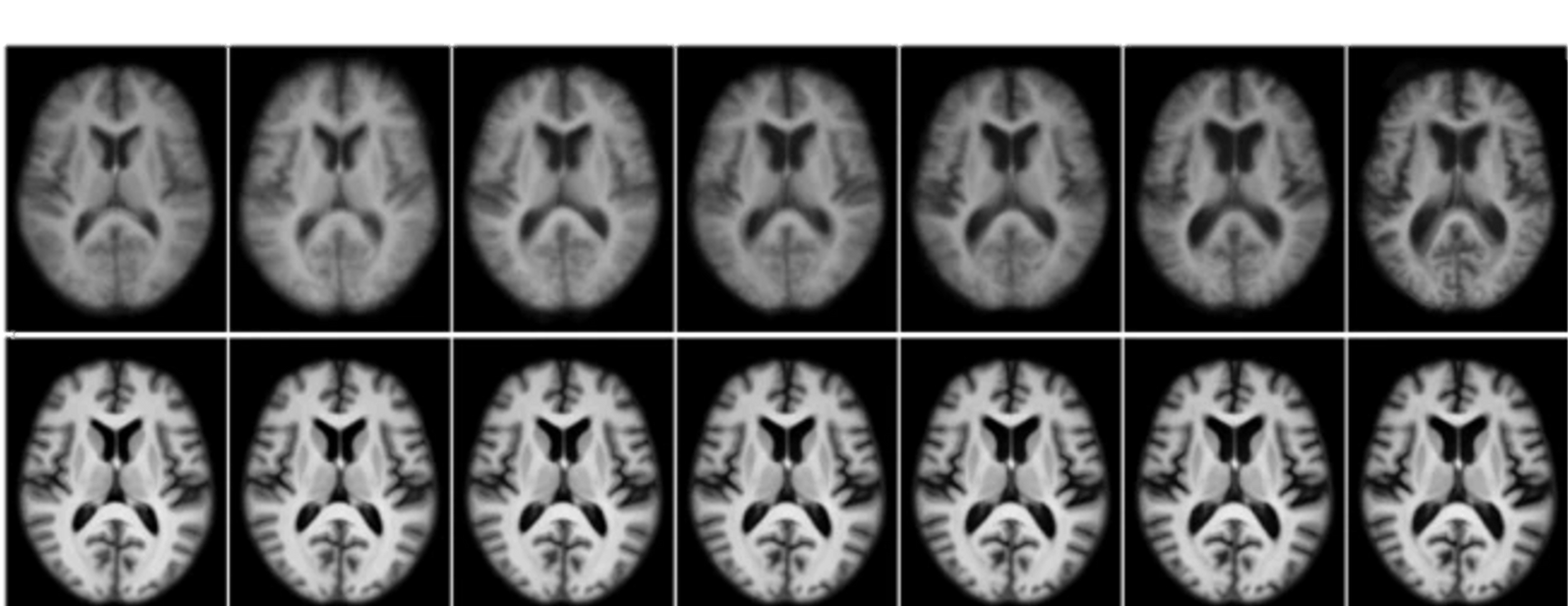 Microscopic close-up of biological fiber tissue - Live Tissue Analysis